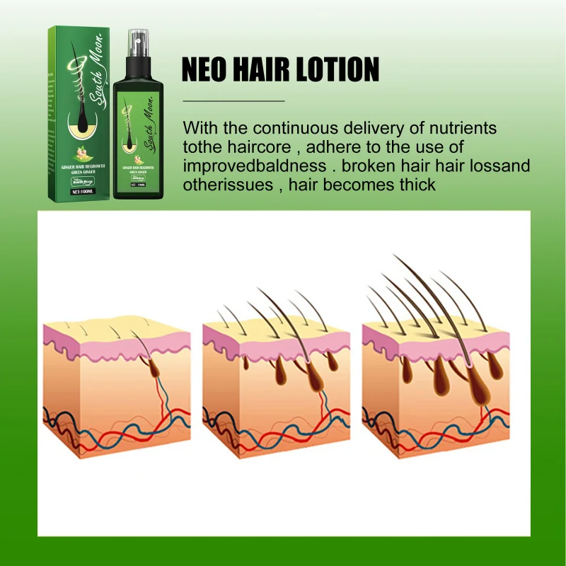 100ML Plaukų Priežiūros aliejus plaukai auga Serumas esminius plaukų slinkimas gydymo produkto plaukų augimą, Moterims, vyrams, originalus Natūralių