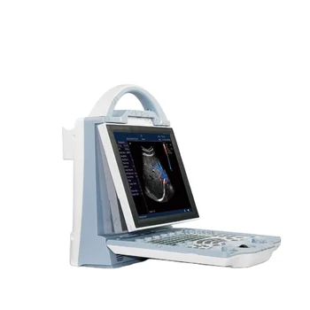 SY-A027 Nešiojamų Ultragarso Aparatas Priemones Spalva Doplerio Echographie 3D 4D Nešiojamas Žmogaus Nėštumo Ultragarso Aparatas